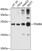 Anti-PSMB6 antibody used in Western Blot (WB). GTX66015