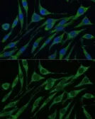 Anti-Valyl tRNA synthetase antibody used in Immunocytochemistry/ Immunofluorescence (ICC/IF). GTX66016