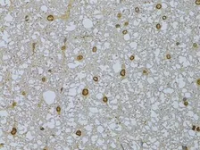 Anti-HDGFRP3 antibody used in IHC (Paraffin sections) (IHC-P). GTX66028