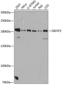 Anti-GIGYF2 antibody used in Western Blot (WB). GTX66085
