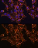 Anti-HSD17B8 antibody used in Immunocytochemistry/ Immunofluorescence (ICC/IF). GTX66143
