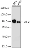 Anti-GBP2 antibody used in Western Blot (WB). GTX66148