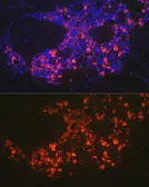 Anti-Neutrophil elastase antibody used in IHC (Paraffin sections) (IHC-P). GTX66150