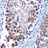 Anti-SENP1 antibody used in IHC (Paraffin sections) (IHC-P). GTX66159