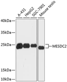Anti-MESDC2 antibody used in Western Blot (WB). GTX66225
