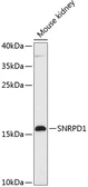 Anti-SNRPD1 antibody used in Western Blot (WB). GTX66260