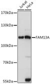Anti-FAM13A antibody used in Western Blot (WB). GTX66269