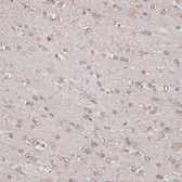 Anti-TLK1 antibody used in IHC (Paraffin sections) (IHC-P). GTX66297