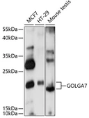 Anti-GOLGA7 antibody used in Western Blot (WB). GTX66306