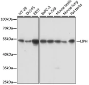 Anti-LIPH antibody used in Western Blot (WB). GTX66344