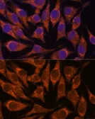 Anti-SEMA3C antibody used in Immunocytochemistry/ Immunofluorescence (ICC/IF). GTX66372