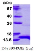 Human HOPX protein, His tag. GTX66445-pro