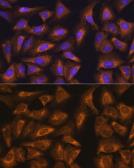 Anti-RPL17 antibody used in Immunocytochemistry/ Immunofluorescence (ICC/IF). GTX66472