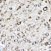 Anti-RPL17 antibody used in IHC (Paraffin sections) (IHC-P). GTX66472