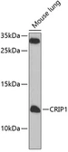 Anti-CRIP1 antibody used in Western Blot (WB). GTX66498