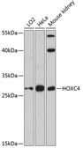 Anti-HOXC4 antibody used in Western Blot (WB). GTX66549