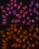 Anti-IMPDH1 antibody used in Immunocytochemistry/ Immunofluorescence (ICC/IF). GTX66572