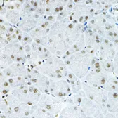 Anti-p66 beta antibody used in IHC (Paraffin sections) (IHC-P). GTX66580
