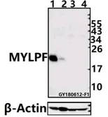 Anti-fast skeletal Myosin antibody used in Western Blot (WB). GTX66608
