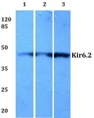 Anti-Kir6.2 antibody used in Western Blot (WB). GTX66690