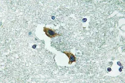 Anti-ATP7A antibody used in IHC (Paraffin sections) (IHC-P). GTX66723