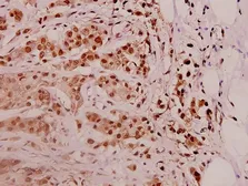 Anti-PSMD11 antibody used in IHC (Paraffin sections) (IHC-P). GTX66726
