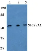 Anti-SLC29A1 antibody used in Western Blot (WB). GTX66737