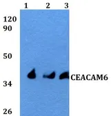 Anti-CEACAM6 antibody used in Western Blot (WB). GTX66780