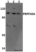 Anti-FNBP3 antibody used in Western Blot (WB). GTX66802