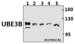 Anti-UBE3B antibody used in Western Blot (WB). GTX66821