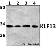 Anti-KLF13 (acetyl lys166) antibody used in Western Blot (WB). GTX66827