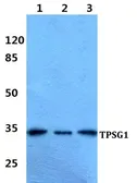 Anti-TPSG1 antibody used in Western Blot (WB). GTX66860