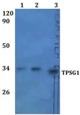 Anti-TPSG1 antibody used in Western Blot (WB). GTX66867