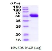 Mouse ALDH2 protein, His tag (active). GTX66920-pro