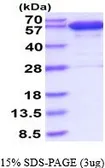 Human Catalase protein, His tag (active). GTX66938-pro