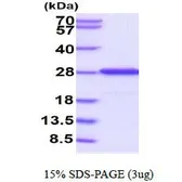 Human FKBP14 protein, His tag (active). GTX66991-pro