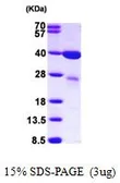 Human Galectin 8 protein, His tag (active). GTX67003-pro