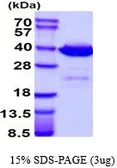 Human Galectin4 protein, His tag (active). GTX67006-pro