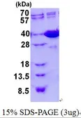 Mouse Galectin4 protein, His tag (active). GTX67007-pro