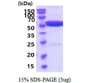 Mouse GPT protein, His tag (active). GTX67025-pro
