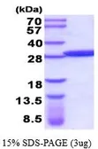 Human GSTM5 protein, His tag (active). GTX67039-pro