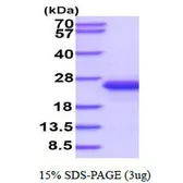 Mouse IL33 protein, His tag (active). GTX67065-pro