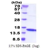 Human Interferon gamma protein (active). GTX67078-pro