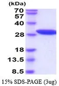 Human NNMT protein, His tag (active). GTX67100-pro