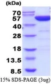 Human PGD protein, His tag (active). GTX67113-pro