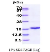 Human PPIL1 protein, His tag (active). GTX67131-pro