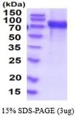 Human VCAM1 / CD106 protein, His tag (active). GTX67183-pro
