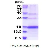 Human VEGF121 protein, His tag (active). GTX67185-pro