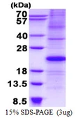 Human p21 Cip1 protein, His tag. GTX67287-pro
