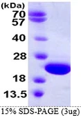 Human CRYGD protein, His tag. GTX67325-pro